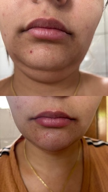Registro de evolução facial de aluna